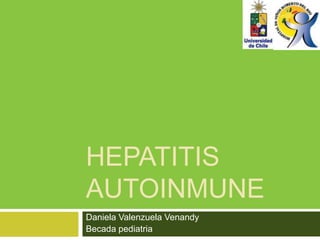 HEPATITIS
AUTOINMUNE
Daniela Valenzuela Venandy
Becada pediatria
 