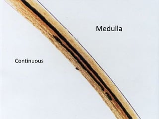 Medulla
Continuous
 