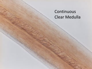 Continuous
Clear Medulla
 
