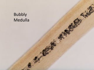 Bubbly
Medulla
 