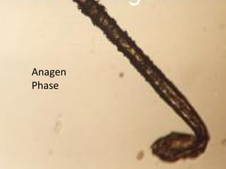 Anagen
Phase
 