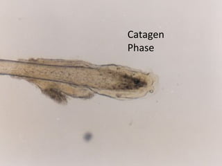 Catagen
Phase
 