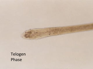 Telogen
Phase
 
