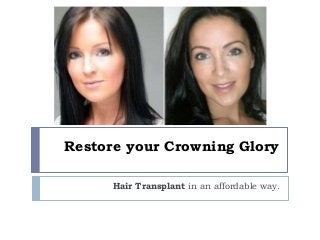 Restore your Crowning Glory
Hair Transplant in an affordable way.

 