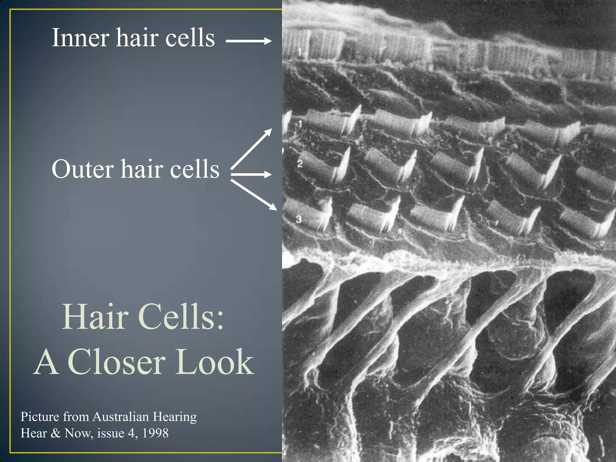 Inner hair cells



     Outer hair cells




   Hair Cells:
  A Closer Look
Picture from Australian Hearing
Hear & Now, issue 4, 1998
 