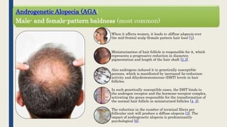 Androgenetic Alopecia (AGA:
Male- and female-pattern baldness (most common)
When it affects women, it leads to diffuse alopecia over
the mid-frontal scalp (female pattern hair loss) [1].
Miniaturization of hair follicle is responsible for it, which
represents a progressive reduction in diameter,
pigmentation and length of the hair shaft [2,3].
Also androgens induced it in genetically susceptible
persons, which is manifested by increased 5α-reductase
activity and dihydrotestosterone (DHT) levels in hair
follicles.
In such genetically susceptible cases, the DHT binds to
the androgen receptor and the hormone-receptor complex,
activating the genes responsible for the transformation of
the normal hair follicle in miniaturized follicles [4, 5].
The reduction in the number of terminal fibers per
follicular unit will produce a diffuse alopecia [3]. The
impact of androgenetic alopecia is predominantly
psychological [6].
 