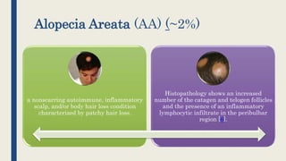 Alopecia Areata (AA) (~2%)
a nonscarring autoimmune, inflammatory
scalp, and/or body hair loss condition
characterized by patchy hair loss.
Histopathology shows an increased
number of the catagen and telogen follicles
and the presence of an inflammatory
lymphocytic infiltrate in the peribulbar
region [6].
 