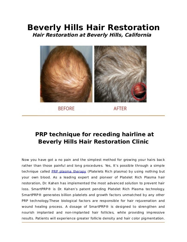Get Your Healthy Hairs Back In Just Few Prp Session For Hair