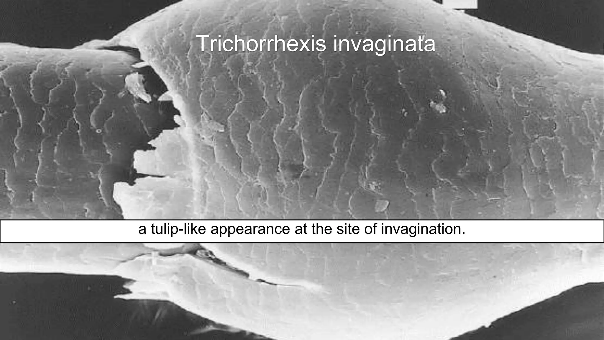 Hair Loss and Trichoscopy | PPTX