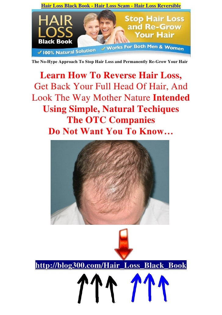 Hair Loss Black Book - Hair Loss Scam - Hair Loss Reversible