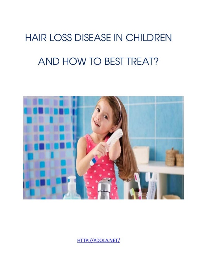 Hair loss disease in children and how to best treat.