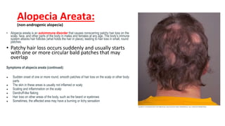 Alopecia Areata:
(non-androgenic alopecia)
• Alopecia areata is an autoimmune disorder that causes nonscarring patchy hair loss on the
scalp, face, and other parts of the body in males and females at any age. The body’s immune
system attacks hair follicles (what holds the hair in place), leading to hair loss in small, round
patches.
• Patchy hair loss occurs suddenly and usually starts
with one or more circular bald patches that may
overlap
Symptoms of alopecia areata (continued):
● Sudden onset of one or more round, smooth patches of hair loss on the scalp or other body
parts
● The skin in these areas is usually not inflamed or scaly
● Scaling and inflammation on the scalp
● Dandruff-like flaking
● Hair loss on other areas of the body, such as the beard or eyebrows
● Sometimes, the affected area may have a burning or itchy sensation
 