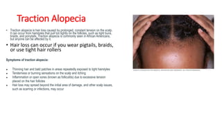 Traction Alopecia
• Traction alopecia is hair loss caused by prolonged, constant tension on the scalp.
It can occur from hairstyles that pull too tightly on the follicles, such as tight buns,
braids, and ponytails. Traction alopecia is commonly seen in African Americans,
but anyone can be affected by it.
• Hair loss can occur if you wear pigtails, braids,
or use tight hair rollers
Symptoms of traction alopecia:
● Thinning hair and bald patches in areas repeatedly exposed to tight hairstyles
● Tenderness or burning sensations on the scalp and itching
● Inflammation or open sores (known as folliculitis) due to excessive tension
placed on the hair follicles
● Hair loss may spread beyond the initial area of damage, and other scalp issues,
such as scarring or infections, may occur
 