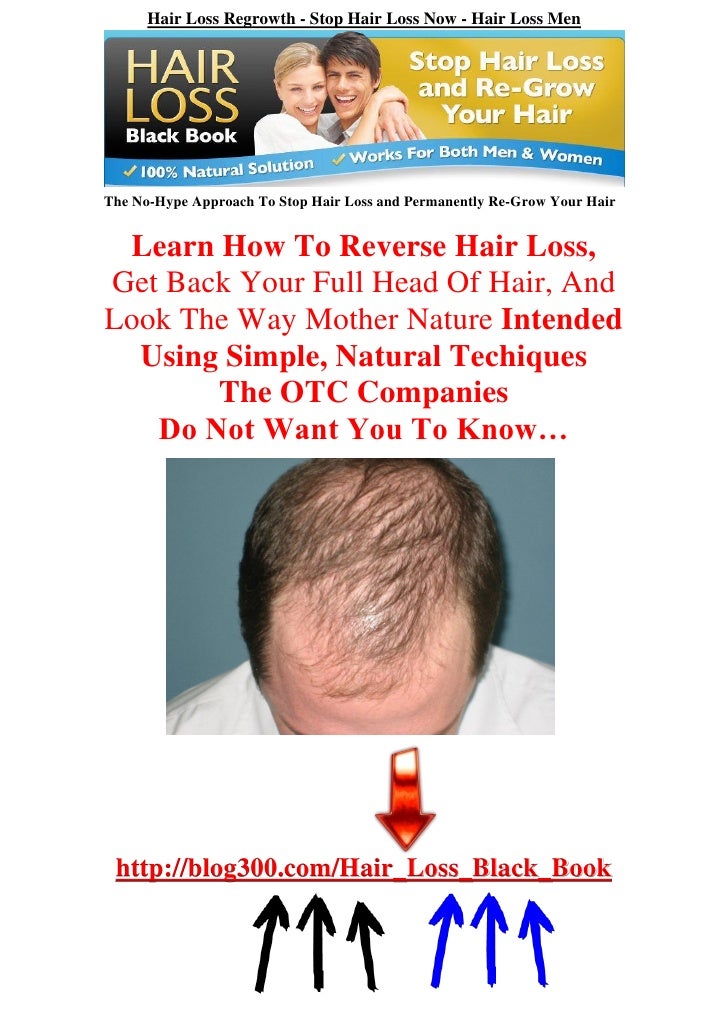Hair Loss Regrowth Stop Hair Loss Now Hair Loss Men