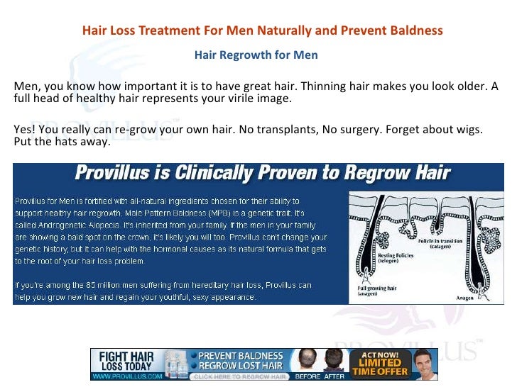 Hair Loss Treatment For Men Naturally And Prevent Baldness