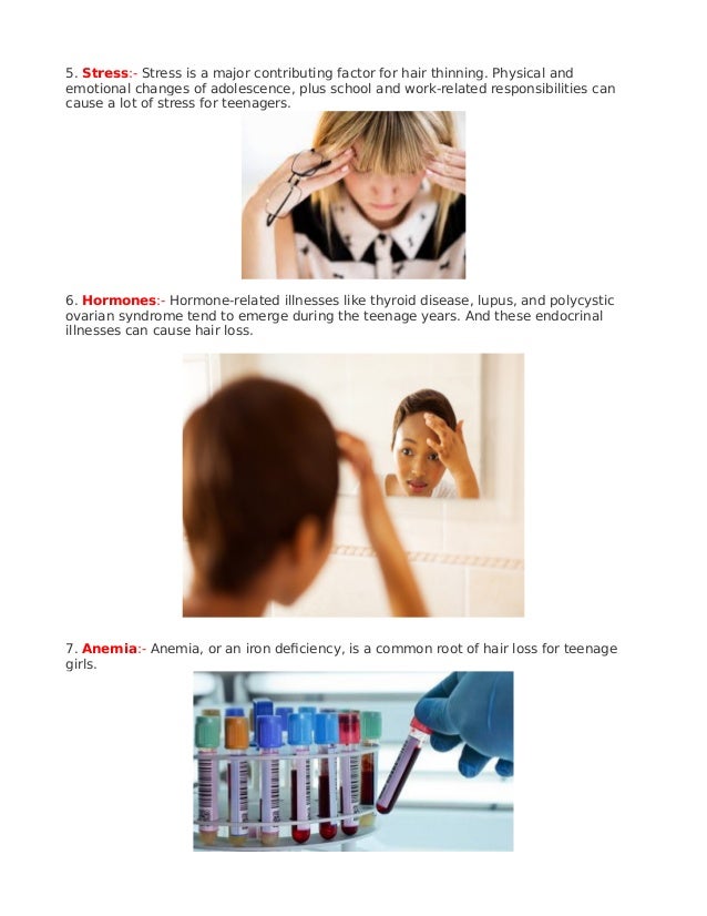 How To Stop Hair Fall Causes Of Hair Loss In Teenage Girls
