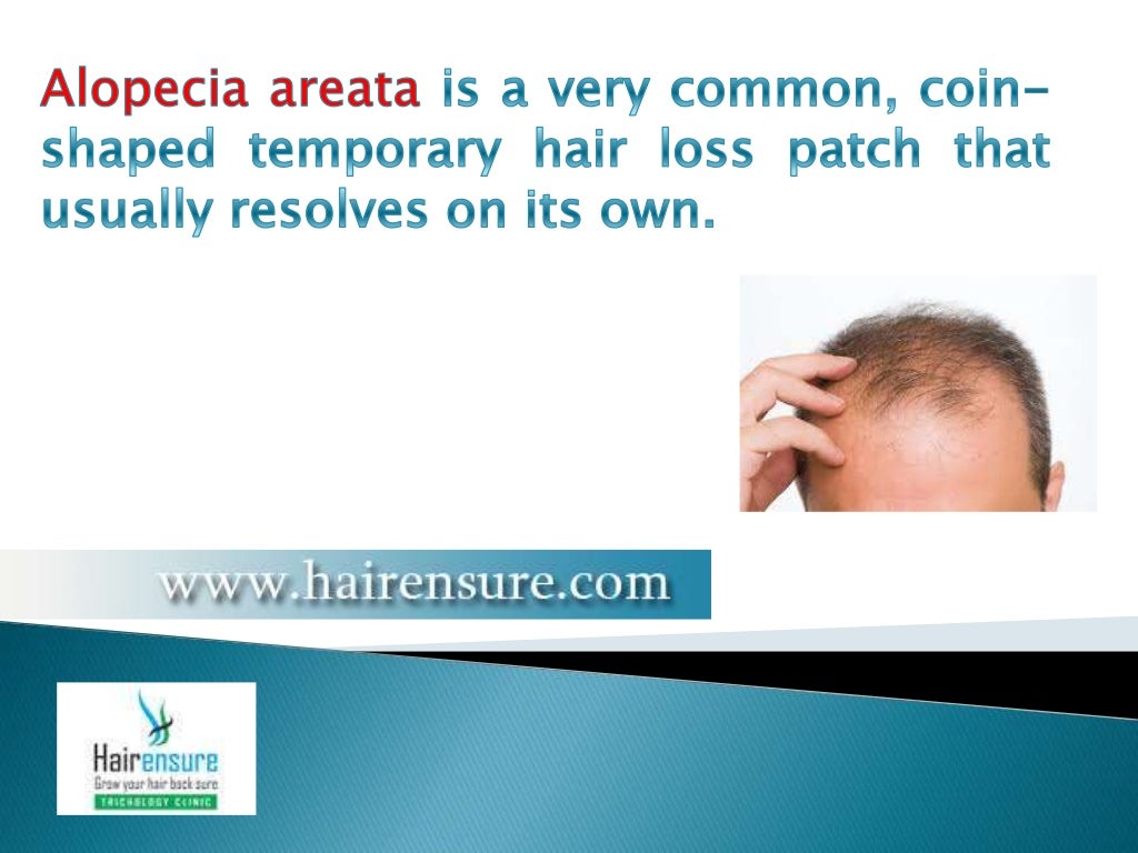 Hair Loss Treatment Vadodara