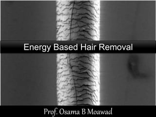 Prof. Osama B Moawad
Energy Based Hair Removal
 