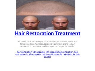 Hair Restoration Treatment
At Good Look Ink, we specialize in the treatment of male and
female pattern hair loss, tailoring treatment plans to hair
restoration treatment and each patient's specific needs.
hair restoration Minneapolis, Minneapolis hair restoration, hair
restoration in Minneapolis, hair loss Minneapolis, solutions for hair
growth
 