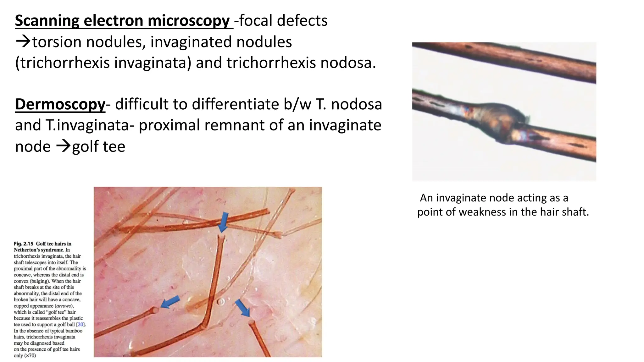 An approach to hair shaft disorders in Dermatology | PDF