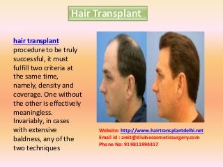 Hair Transplant
hair transplant
procedure to be truly
successful, it must
fulfill two criteria at
the same time,
namely, density and
coverage. One without
the other is effectively
meaningless.
Invariably, in cases
with extensive
baldness, any of the
two techniques
Website: http://www.hairtransplantdelhi.net
Email id : amit@divinecosmeticsurgery.com
Phone No: 919811994417
 
