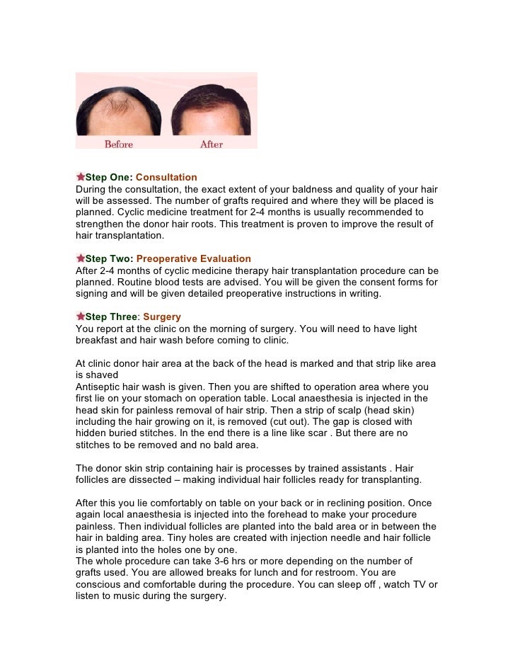 Hair Transplantation Surgery by Dr Priti Shukla Cosmetic ...