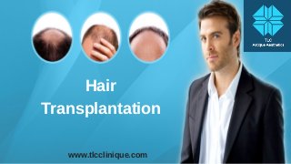 Hair
Transplantation
www.tlcclinique.com
 