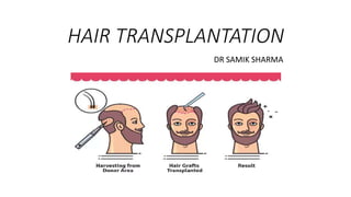 HAIR TRANSPLANTATION
DR SAMIK SHARMA
 