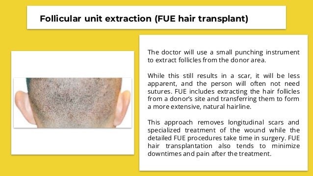 Hair Transplant Before And After | PDF