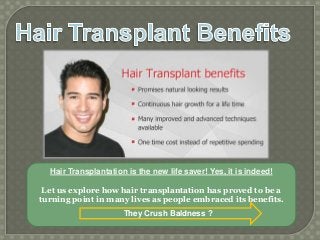 Hair Transplantation is the new life saver! Yes, it is indeed!
Let us explore how hair transplantation has proved to be a
turning point in many lives as people embraced its benefits.
They Crush Baldness ?
 