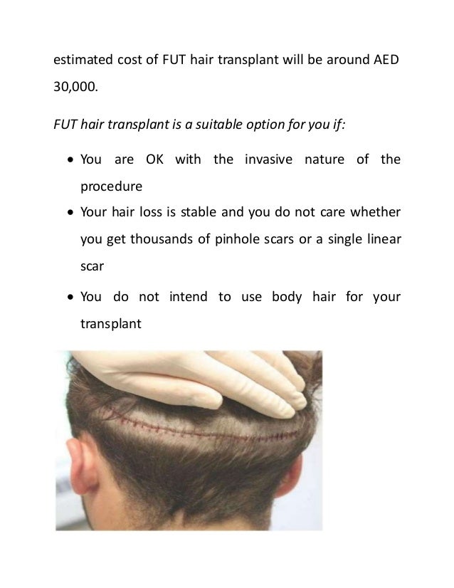 Hair Transplant Cost in Saudi Arabia and Dubai