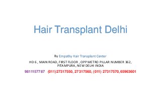 Hair Transplant Delhi
By Empathy Hair Transplant Center
HD 6 , MAIN ROAD, FIRST FLOOR , OPP METRO PILLAR NUMBER 362,
PITAMPURA, NEW DELHI INDIA
9811157787 (011)27317550, 27317560, (011) 27317570,65963601
 