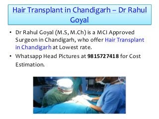 Hair Transplant in Chandigarh – Dr Rahul
Goyal
• Dr Rahul Goyal (M.S, M.Ch) is a MCI Approved
Surgeon in Chandigarh, who offer Hair Transplant
in Chandigarh at Lowest rate.
• Whatsapp Head Pictures at 9815727418 for Cost
Estimation.
 