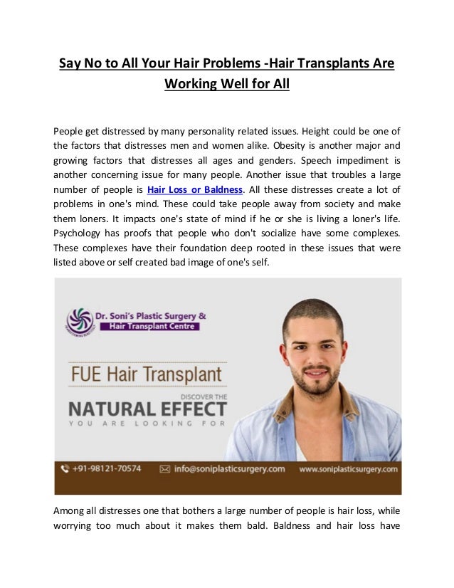 Hair Transplant In Delhi Reviews