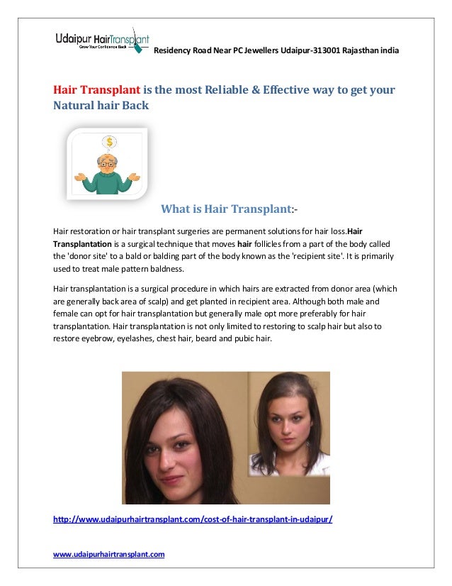 Hair Transplant Is The Most Reliable Amp Effective Way To Get Your