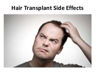 Hair Transplant Side Effects
 