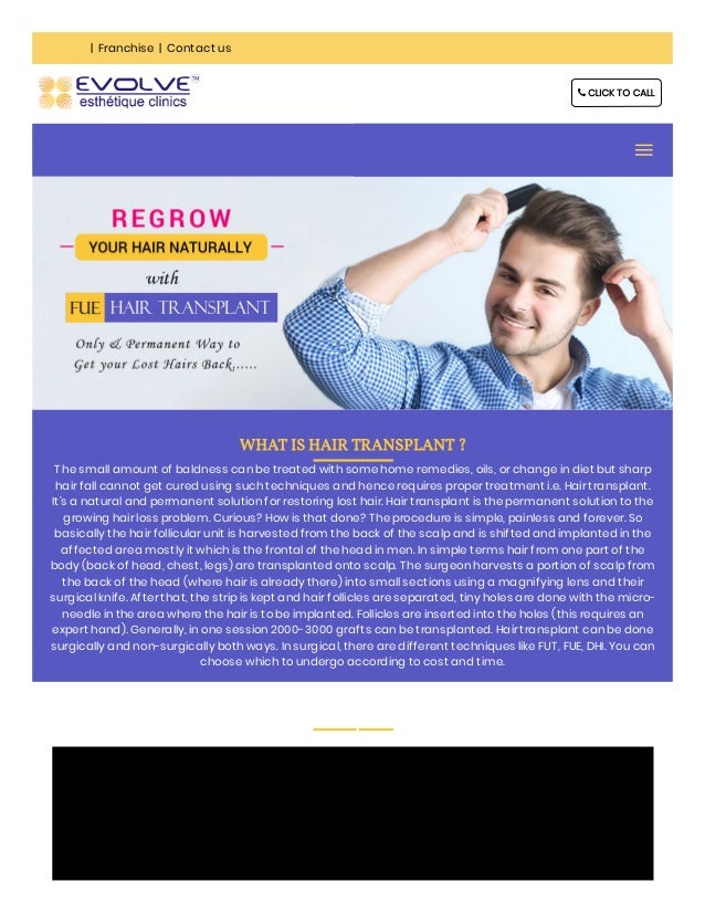 Hair Transplant Surgery Fue Fut Hair Transplant Evolve Esthetiq