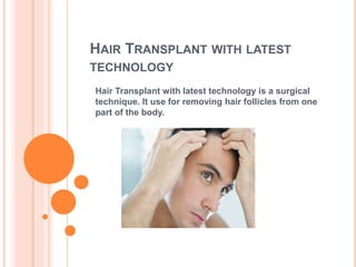 HAIR TRANSPLANT WITH LATEST
TECHNOLOGY
Hair Transplant with latest technology is a surgical
technique. It use for removing hair follicles from one
part of the body.
 