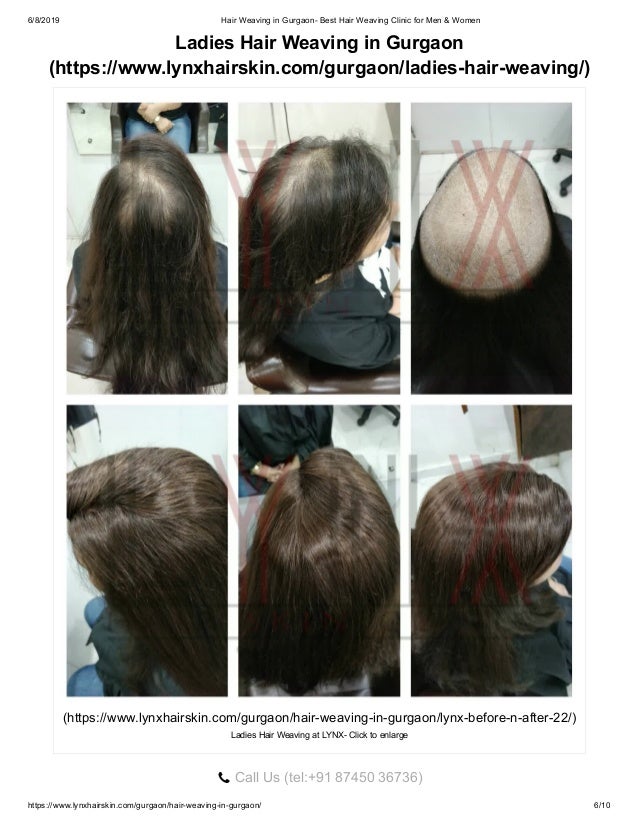 Hair Weaving In Gurgaon Best Hair Weaving Clinic For Men Amp Women