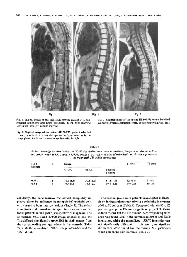Hairy cell leukemia and magnetic resonance imaging in diffuse malignant ... - Bone Marrow Imaging Modalities For Leukemia