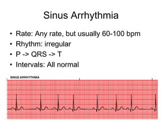 Basic EKG and Rhythm Interpretation Symposia - The CRUDEM Foundation | PPT