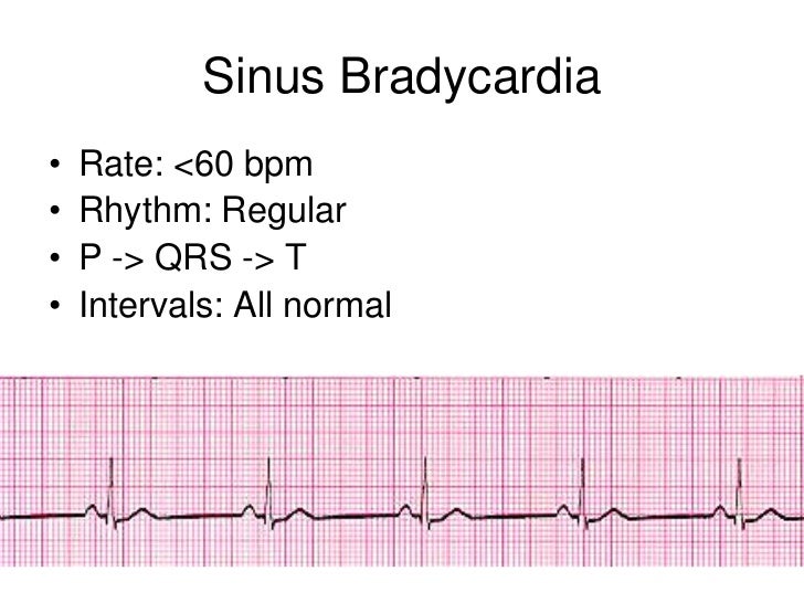Basic Ekg And Rhythm Interpretation Symposia The Crudem Foundation