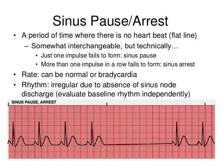 Basic Ekg And Rhythm Interpretation Symposia The Crudem Foundation