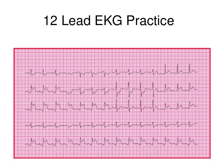 Basic Ekg And Rhythm Interpretation Symposia The Crudem Foundation