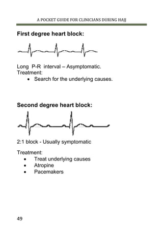 A POCKET GUIDE FOR CLINICIANS DURING HAJJ
49
First degree heart block:
Long P-R interval – Asymptomatic.
Treatment:
 Search for the underlying causes.
Second degree heart block:
2:1 block - Usually symptomatic
Treatment:
 Treat underlying causes
 Atropine
 Pacemakers
 