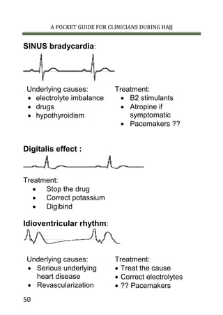 A POCKET GUIDE FOR CLINICIANS DURING HAJJ
50
SINUS bradycardia:
Underlying causes: Treatment:
 electrolyte imbalance
 drugs
 hypothyroidism
 B2 stimulants
 Atropine if
symptomatic
 Pacemakers ??
Digitalis effect :
Treatment:
 Stop the drug
 Correct potassium
 Digibind
Idioventricular rhythm:
Underlying causes: Treatment:
 Serious underlying
heart disease
 Revascularization
 Treat the cause
 Correct electrolytes
 ?? Pacemakers
 