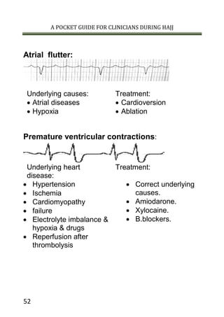 A POCKET GUIDE FOR CLINICIANS DURING HAJJ
52
Atrial flutter:
Underlying causes: Treatment:
 Atrial diseases
 Hypoxia
 Cardioversion
 Ablation
Premature ventricular contractions:
Underlying heart
disease:
Treatment:
 Hypertension
 Ischemia
 Cardiomyopathy
 failure
 Electrolyte imbalance &
hypoxia & drugs
 Reperfusion after
thrombolysis
 Correct underlying
causes.
 Amiodarone.
 Xylocaine.
 B.blockers.
 
