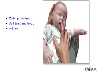 ● Zatim proverimo
● da li je strano telo u
● ustima
 