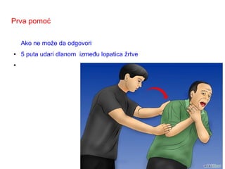 Prva pomoć
Ako ne može da odgovori
● 5 puta udari dlanom između lopatica žrtve
●
 