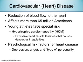 © Cengage Learning 2016
• Reduction of blood flow to the heart
• Affects more than 65 million Americans
• Young athletes f...
